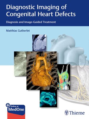 cover image of Diagnostic Imaging of Congenital Heart Defects